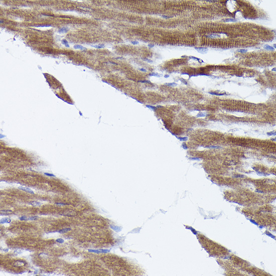 Immunohistochemistry of paraffin-embedded rat heart using [KO Validated] PHD2/EGLN1 Polyclonal Antibody at dilution of 1:100 (40x lens).Perform high pressure antigen retrieval with 10 mM citrate buffer pH 6.0 before commencing with IHC staining protocol.