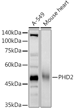 Western blot analysis of extracts of various cell lines using PHD2/EGLN1 Polyclonal Antibody at 1:1000 dilution.