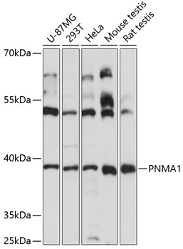 Western blot analysis of extracts of various cell lines using PNMA1 Polyclonal Antibody at 1:3000 dilution.