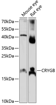 Western blot analysis of extracts of various cell lines using CRYGB Polyclonal Antibody at 1:1000 dilution.