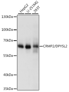 Western blot analysis of extracts of various cell lines using CRMP2/CRMP2/DPYSL2 Polyclonal Antibody at 1:1000 dilution.