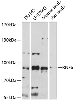 Western blot analysis of extracts of various cell lines using RNF6 Polyclonal Antibody at 1:1000 dilution.