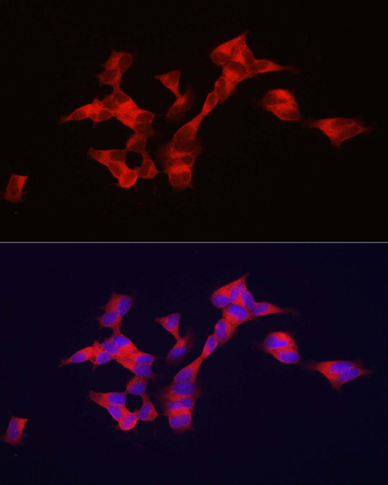 Immunofluorescence analysis of SH-SY5Y cells using BSCL2 Polyclonal Antibody at dilution of 1:100. Blue: DAPI for nuclear staining.