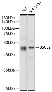 Western blot analysis of extracts of various cell lines using BSCL2 Polyclonal Antibody at 1:1000 dilution.