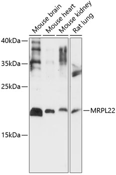 Western blot analysis of extracts of various cell lines using MRPL22 Polyclonal Antibody at 1:1000 dilution.