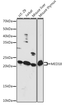 Western blot analysis of extracts of various cell lines using MED18 Polyclonal Antibody at 1:1000 dilution.