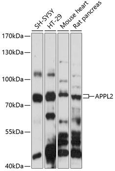 Western blot analysis of extracts of various cell lines using APPL2 Polyclonal Antibody at 1:1000 dilution.