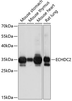 Western blot analysis of extracts of various cell lines using ECHDC2 Polyclonal Antibody at 1:1000 dilution.