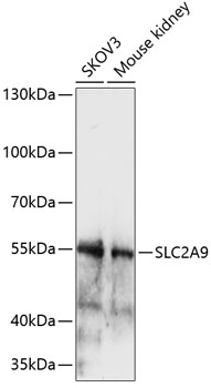 Western blot analysis of extracts of various cell lines using SLC2A9 Polyclonal Antibody at 1:1000 dilution.