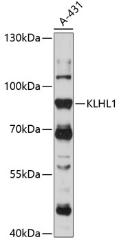 Western blot analysis of extracts of A-431 cells using KLHL1 Polyclonal Antibody at 1:1000 dilution.