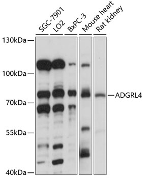 Western blot analysis of extracts of various cell lines using ADGRL4 Polyclonal Antibody at 1:1000 dilution.