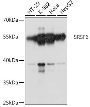 Western blot analysis of extracts of various cell lines using SRSF6 Polyclonal Antibody at 1:1000 dilution.