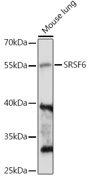 Western blot analysis of extracts of Mouse lung using SRSF6 Polyclonal Antibody at 1:1000 dilution.