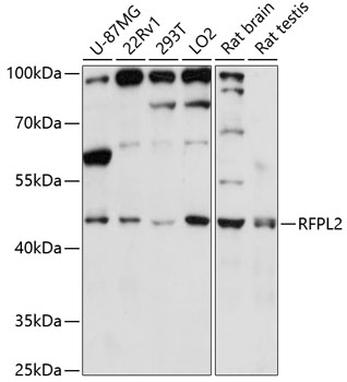 Western blot analysis of extracts of various cell lines using RFPL2 Polyclonal Antibody at 1:3000 dilution.