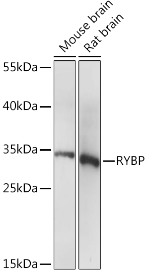 Western blot analysis of extracts of various cell lines using RYBP Polyclonal Antibody at1:1000 dilution.