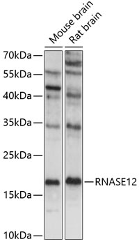 Western blot analysis of extracts of various cell lines using RNASE12 Polyclonal Antibody at 1:1000 dilution.