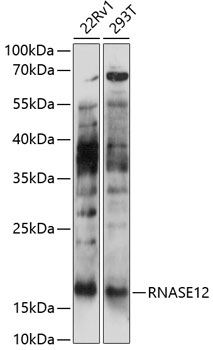 Western blot analysis of extracts of various cell lines using RNASE12 Polyclonal Antibody at 1:1000 dilution.