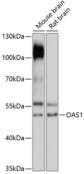 Western blot analysis of extracts of various cell lines using OAS1 Polyclonal Antibody at 1:3000 dilution.