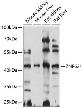 Western blot analysis of extracts of various cell lines using ZNF621 Polyclonal Antibody at 1:1000 dilution.