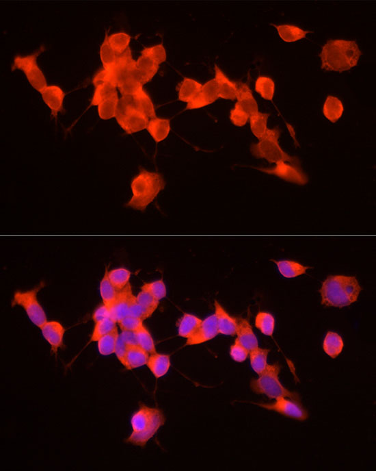 Immunofluorescence analysis of SH-SY5Y cells using GDNF Polyclonal Antibody at dilution of 1:100 (40x lens). Blue: DAPI for nuclear staining.