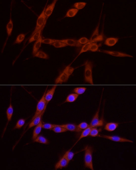 Immunofluorescence analysis of U-87MG cells using GDNF Polyclonal Antibody at dilution of 1:100 (40x lens). Blue: DAPI for nuclear staining.