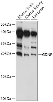 Western blot analysis of extracts of various cell lines using GDNF Polyclonal Antibody at 1:1000 dilution.