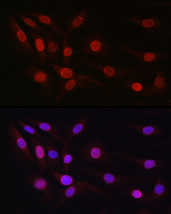 Immunofluorescence analysis of NIH/3T3 cells using SP1 Polyclonal Antibody at dilution of 1:50 (40x lens). Blue: DAPI for nuclear staining.