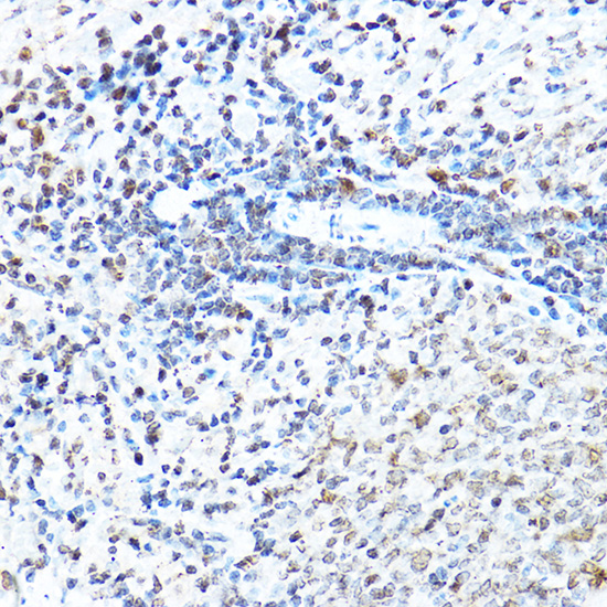 Immunohistochemistry of paraffin-embedded rat spleen using SP1 Polyclonal Antibody at dilution of 1:50 (40x lens).Perform high pressure antigen retrieval with 10 mM citrate buffer pH 6.0 before commencing with IHC staining protocol.