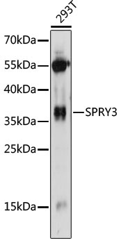 Western blot analysis of extracts of 293T cells using SPRY3 Polyclonal Antibody at 1:1000 dilution.