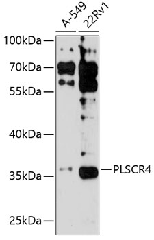 Western blot analysis of extracts of various cell lines using PLSCR4 Polyclonal Antibody at 1:3000 dilution.