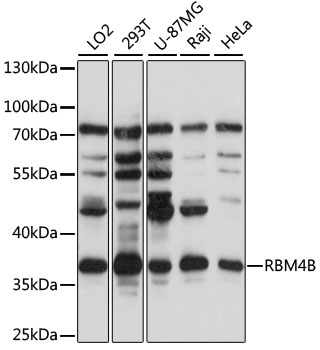 Western blot analysis of extracts of various cell lines using RBM4B Polyclonal Antibody at 1:1000 dilution.