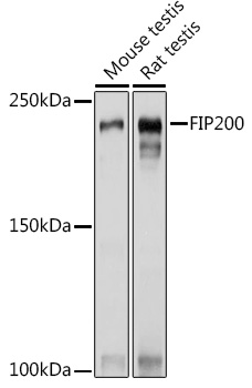 Western blot analysis of extracts of various cell lines using FIP200 Polyclonal Antibody at1:1000 dilution.