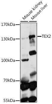 Western blot analysis of extracts of various cell lines using TEX2 Polyclonal Antibody at 1:1000 dilution.