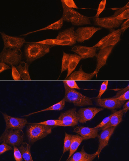 Immunofluorescence analysis of NIH/3T3 cells using Apolipoprotein A2 Polyclonal Antibody at dilution of 1:100. Blue: DAPI for nuclear staining.