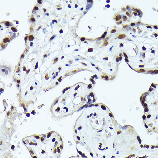 Immunohistochemistry of paraffin-embedded human placenta using FOSB Polyclonal Antibody at dilution of 1:100 (40x lens).Perform high pressure antigen retrieval with 10 mM citrate buffer pH 6.0 before commencing with IHC staining protocol.