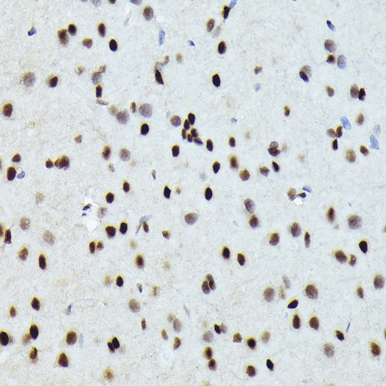 Immunohistochemistry of paraffin-embedded rat brain using FOSB Polyclonal Antibody at dilution of 1:100 (40x lens).Perform high pressure antigen retrieval with 10 mM citrate buffer pH 6.0 before commencing with IHC staining protocol.