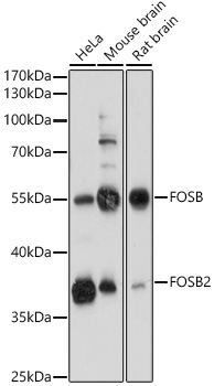 Western blot analysis of extracts of various cell lines using FOSB Polyclonal Antibody at 1:1000 dilution.