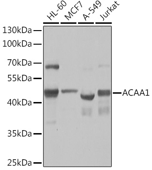 Western blot analysis of extracts of various cell lines using ACAA1 Polyclonal Antibody at1:1000 dilution.