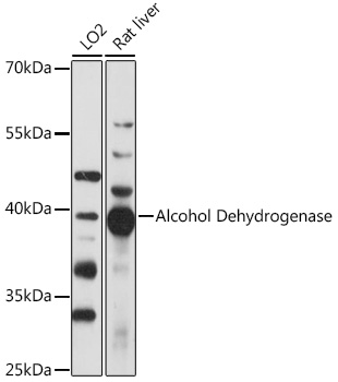 Western blot analysis of extracts of various cell lines using Alcohol Dehydrogenase Polyclonal Antibody at 1:1000 dilution.