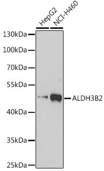 Western blot analysis of extracts of various cell lines using ALDH3B2 Polyclonal Antibody at 1:3000 dilution.