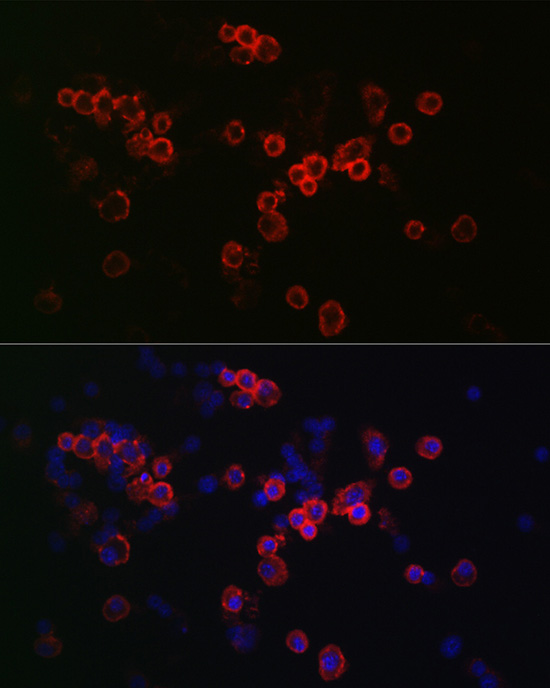 Immunofluorescence analysis of RAW264.7 cells using CCR7 Polyclonal Antibody at dilution of 1:50 (40x lens). Blue: DAPI for nuclear staining.