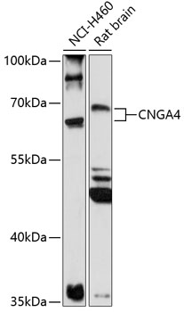 Western blot analysis of extracts of various cell lines using CNGA4 Polyclonal Antibody at 1:1000 dilution.