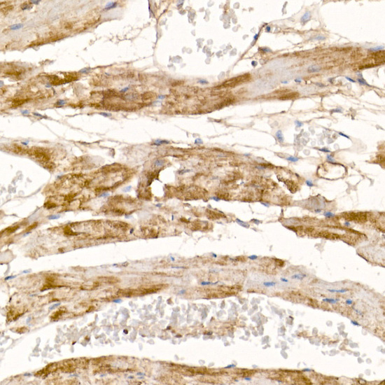 Immunohistochemistry of paraffin-embedded mouse heart using COX7A1 Polyclonal Antibody at dilution of 1:100 (40x lens).Perform high pressure antigen retrieval with 10 mM citrate buffer pH 6.0 before commencing with IHC staining protocol.