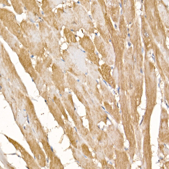 Immunohistochemistry of paraffin-embedded rat heart using COX7A1 Polyclonal Antibody at dilution of 1:100 (40x lens).Perform high pressure antigen retrieval with 10 mM citrate buffer pH 6.0 before commencing with IHC staining protocol.