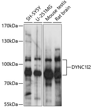 Western blot analysis of extracts of various cell lines using DYNC1I2 Polyclonal Antibody at 1:1000 dilution.