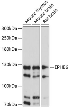 Western blot analysis of extracts of various cell lines using EPHB6 Polyclonal Antibody at 1:1000 dilution.