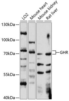 Western blot analysis of extracts of various cell lines using GHR Polyclonal Antibody at 1:1000 dilution.