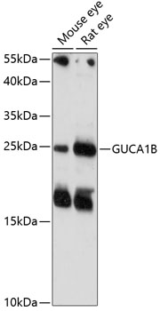 Western blot analysis of extracts of various cell lines using GUCA1B Polyclonal Antibody at 1:1000 dilution.