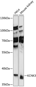 Western blot analysis of extracts of various cell lines using KCNK3 Polyclonal Antibody at 1:1000 dilution.