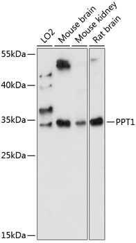 Western blot analysis of extracts of various cell lines using PPT1 Polyclonal Antibody at 1:1000 dilution.